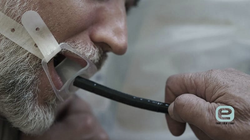 Gastroskopia: czy boli? przebieg badania, przygotowanie i znieczulenie