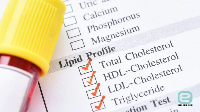 Lipidogram: normy cholesterolu i interpretacja wyników krok po kroku