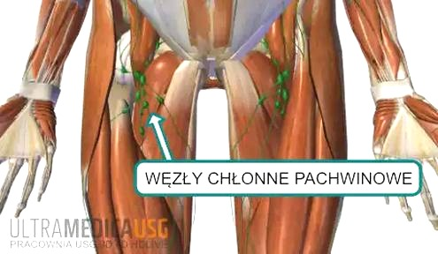Węzły chłonne pachwinowe: skąd bierze się guzek i kiedy wymaga konsultacji?