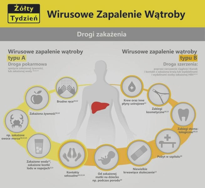 Zapalenie wątroby: objawy, wyniki badań i sygnały alarmowe