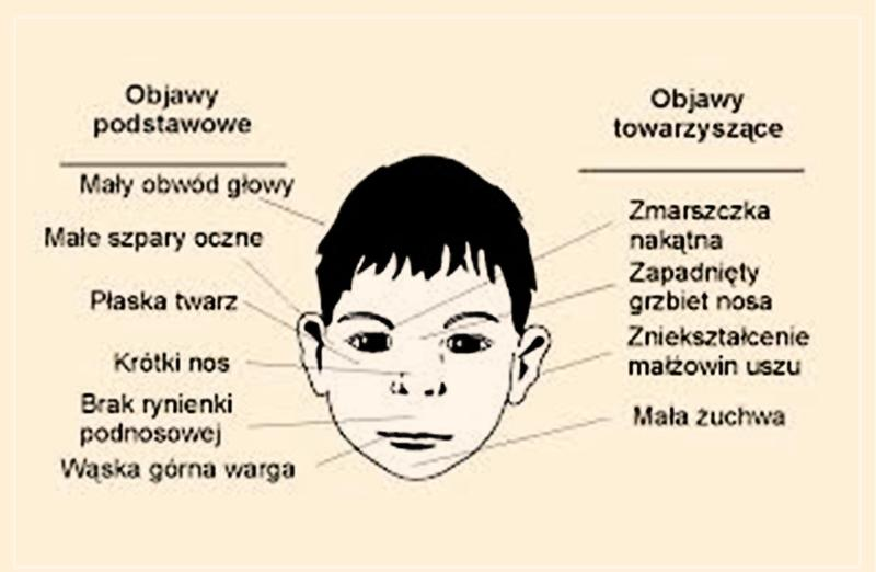 Alkohol w ciąży