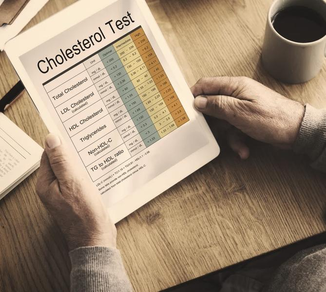 Cholesterol LDL