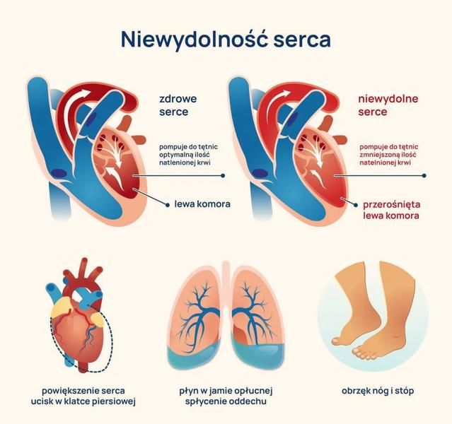 Diagnostyka niewydolności serca