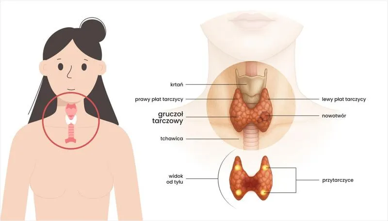 Diagnostyka tarczycy