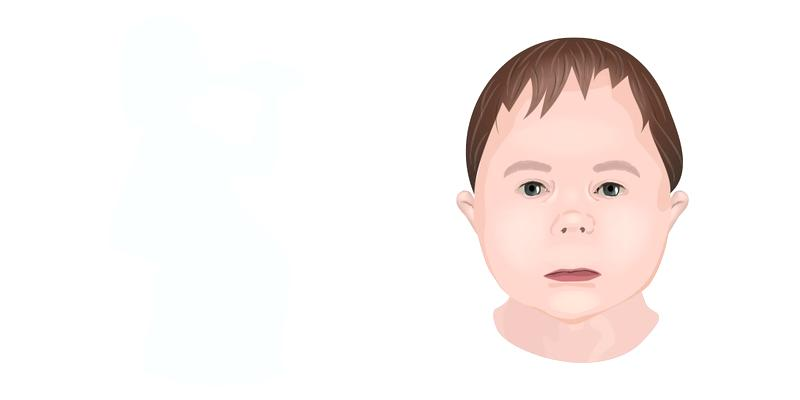 FASD konsekwencje