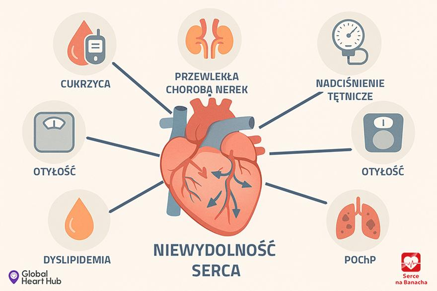 Leczenie niewydolności serca