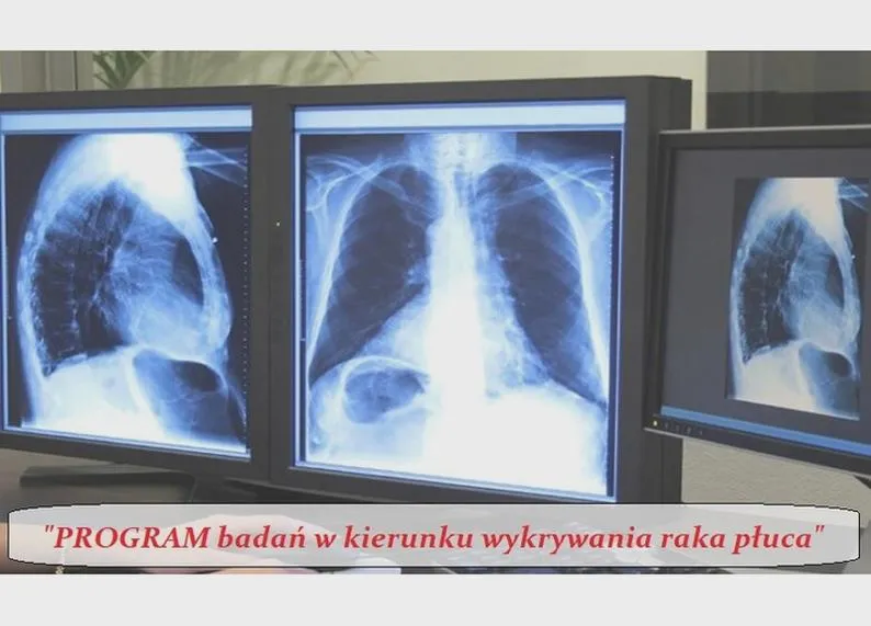 Objawy raka płuca