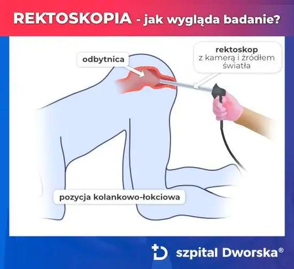 Przygotowanie do rektoskopii