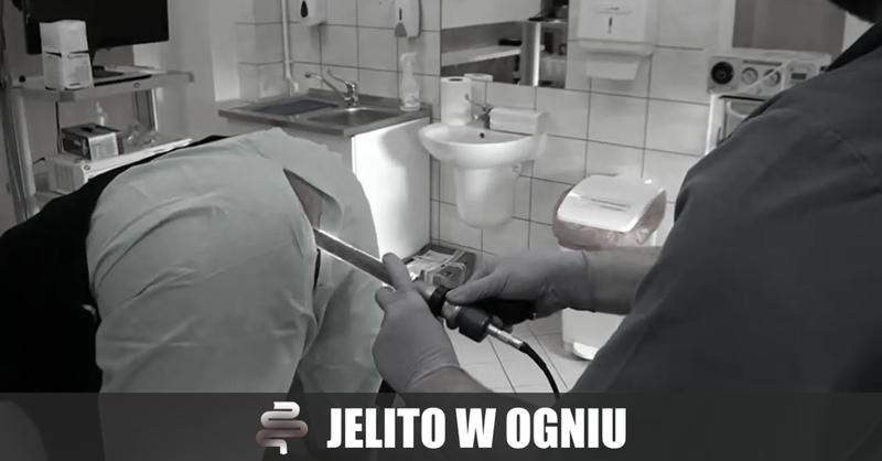 Rektoskopia badanie