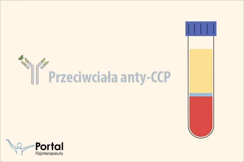 Zdrowie stawów